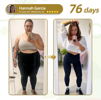 Lyyeto® 💕💕𝐌𝐨𝐫𝐢𝐧𝐠𝐚+𝐍𝐚𝐧𝐨 𝐌𝐢𝐜𝐫𝐨𝐧𝐞𝐞𝐝𝐥𝐞 𝐏𝐚𝐭𝐜𝐡 𝐰𝐢𝐭𝐡 𝐒𝐌𝐆𝐓-𝐆𝐋𝐏-𝟏 & 𝐌𝐚𝐭𝐫𝐢𝐱𝐲𝐥 𝟑𝟎𝟎𝟎 – 𝐒𝐥𝐢𝐦𝐦𝐢𝐧𝐠, 𝐒𝐤𝐢𝐧 𝐓𝐢𝐠𝐡𝐭𝐞𝐧𝐢𝐧𝐠, 𝐁𝐥𝐨𝐨𝐝 𝐒𝐮𝐠𝐚𝐫 𝐒𝐮𝐩𝐩𝐨𝐫𝐭, 𝐍𝐨 𝐈𝐧𝐣𝐞𝐜𝐭𝐢𝐨𝐧, 𝟕-𝐃𝐚𝐲 𝐑𝐞𝐬𝐮𝐥𝐭🥇